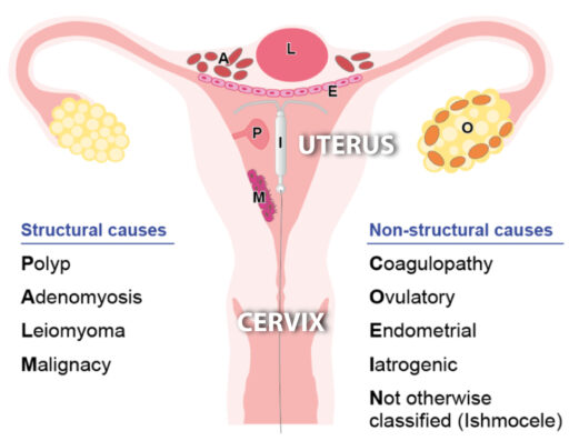 what-is-abnormal-uterine-bleeding-ruach